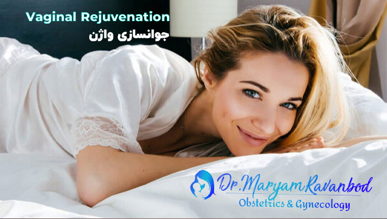جوانسازی واژن و تنگ کردن واژن با دستگاه Rf جراح متخصص زنان و زایمان در شیراز دکتر مریم